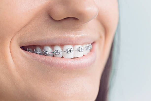 Best Teeth Whitening  in Calumet Park, IL